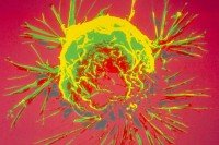 Illustration of breast cancer cell