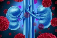 Illustration of blue kidneys with large red cancer cells floating around them.