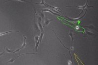 black and white image of cells under a microscope