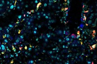 An immunofluorescence image of an aged mouse liver.