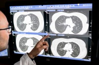 A computer screen displays four scans of lungs.