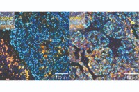 microscope images showing cells with whole-genome doubling