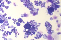 hematopoietic stem and progenitor cells