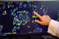 A researcher points to cells on a screen