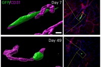 Scientific image showing spindle-shaped and round dormant metastatic cancer cells
