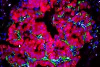 colorful microscope image of cancer cells