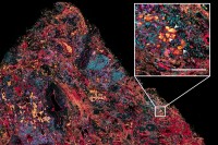 scientific image of lung cancer