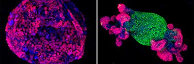 Organoid cell structures fluorescing in blue, green, and purple. 