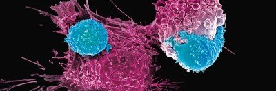 CAR T Cells: Timeline of Progress