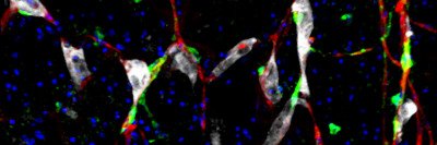 This image shows cancer cells (white) and pericytes (green) clinging to capillaries (red). The blue dots are nuclei.