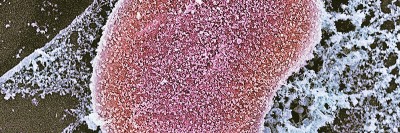 A micrograph of a cell nucleus
