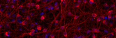 Human pluripotent stem cell-derived neurons