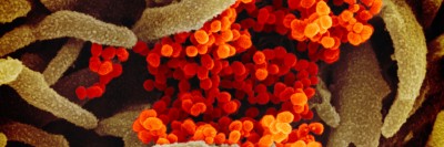 microscope image of the SARS-CoV-2 virus