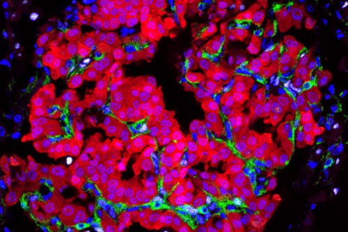 colorful microscope image of cancer cells