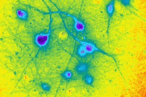 Pictured: Nerve cells generated from embryonic stem cells and manipulated by a technology called optogenetics. Memorial Sloan Kettering scientists are using stem-cell engineering to develop new treatments for Parkinson’s disease.