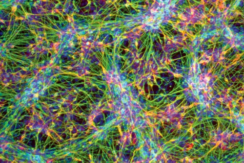 Pictured: Immature nerve cells are differentiating into the pain-sensing cells of the peripheral nervous system.