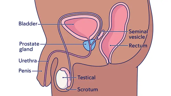 Illustration of the prostate gland, as well as the bladder, seminal vesicle, rectum, testicle, and scrotum. 