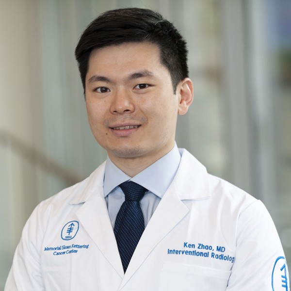 Memorial Sloan Kettering interventional radiologist Ken Zhao