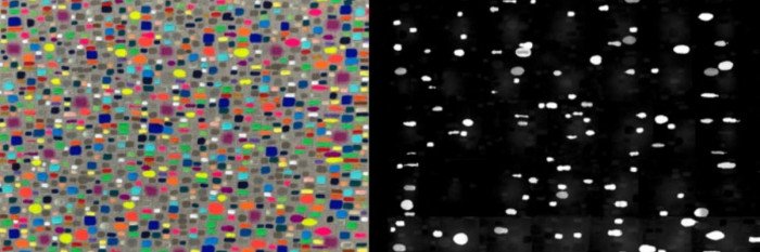 Diagnostic Technologies for Early Cancer Detection | Sloan Kettering ...