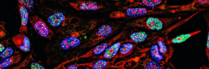 MSK-IMPACT: A Comprehensive Tumor Sequencing Test to Detect Targetable ...